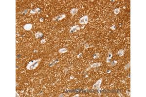 Immunohistochemistry of Human brain  using SLC25A13 Polyclonal Antibody at dilution of 1:35 (slc25a13 anticorps)