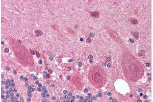 Human Brain, Cerebellum (formalin-fixed, paraffin-embedded) stained with OPTN antibody ABIN214196 at 10 ug/ml followed by biotinylated goat anti-rabbit IgG secondary antibody ABIN481713, alkaline phosphatase-streptavidin and chromogen.