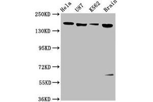 Western Blot Positive WB detected in: Hela whole cell lysate, U87 whole cell lysate, K562 whole cell lysate, Rat brain tissue All lanes: LIFR antibody at 3. (LIFR anticorps  (AA 915-1086))