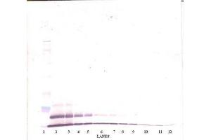 Image no. 3 for anti-Growth Regulated Oncogene gamma (GRO gamma) antibody (ABIN465908) (GRO gamma anticorps)