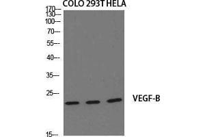 Western Blot (WB) analysis of specific cells using VEGF-B Polyclonal Antibody. (VEGFB anticorps  (Internal Region))
