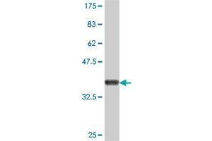 Western Blot detection against Immunogen (35.