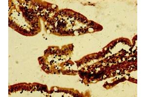 Immunohistochemistry of paraffin-embedded human small intestine tissue using ABIN7144231 at dilution of 1:100