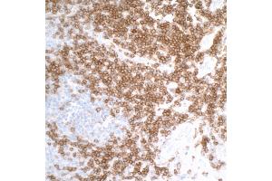 anti-CD27 Molecule (CD27) (AA 21-187) antibody