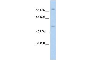 WB Suggested Anti-NR3C1 Antibody Titration: 1. (Glucocorticoid Receptor anticorps  (N-Term))