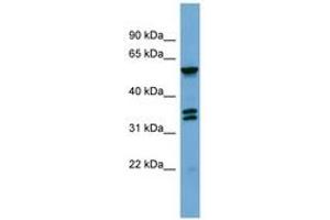 Image no. 1 for anti-G Protein-Coupled Receptor Kinase 4 (GRK4) (AA 359-408) antibody (ABIN6745674) (GRK4 anticorps  (AA 359-408))