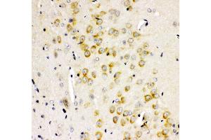 Anti- GRIA2 antibody, IHC(P) IHC(P): Rat Brain Tissue (GRIA2 anticorps  (AA 25-360))
