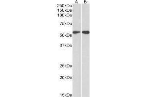 ABIN2613493 (2µg/ml) staining of HeLa (A) and Jurkat (B) lysates (35µg protein in RIPA buffer). (Vimentin anticorps  (C-Term))