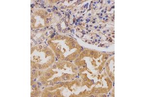 (ABIN391779 and ABIN2841638) staining HIPK3 in human kidney tissue sections by Immunohistochemistry (IHC-P - paraformaldehyde-fixed, paraffin-embedded sections). (HIPK3 anticorps  (C-Term))