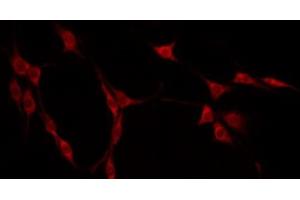 ABIN6275163 staining Hela by IF/ICC. (GIDRP88 anticorps  (C-Term))
