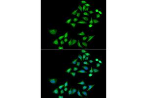 Immunofluorescence analysis of A549 cell using KLK4 antibody. (Kallikrein 4 anticorps)
