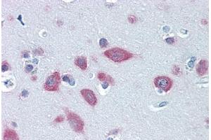 Human Brain, Cortex: Formalin-Fixed, Paraffin-Embedded (FFPE) (FARSB anticorps  (AA 234-342))