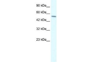 RGS6 antibody used at 2 ug/ml to detect target protein. (RGS6 anticorps  (C-Term))