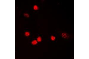 Immunofluorescent analysis of p53 (AcK319) staining in HeLa cells. (p53 anticorps  (acLys319, C-Term))