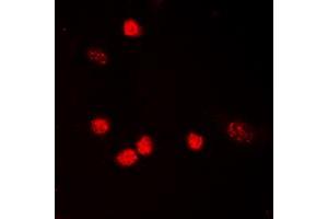 Immunofluorescent analysis of p53 (AcK319) staining in HeLa cells. (p53 anticorps  (acLys319, C-Term))