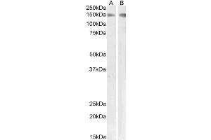 Western Blotting (WB) image for anti-phospholipase A2 Receptor 1, 180kDa (PLA2R1) antibody (ABIN5932307) (PLA2R1 anticorps)