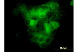 Immunofluorescence of monoclonal antibody to MAP3K5 on A-431 cell.