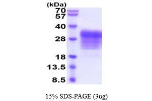 SDS-PAGE (SDS) image for Leukemia Inhibitory Factor (LIF) (AA 23-202) (Active) protein (His tag) (ABIN5854824)