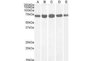 ABIN185199 (0. (DDX5 anticorps  (C-Term))