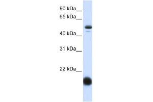 SLC22A7 antibody used at 1 ug/ml to detect target protein. (SLC22A7 anticorps)