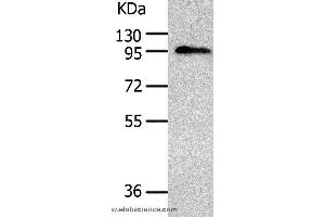 Western blot analysis of Human liver cancer tissue, using AKAP8 Polyclonal Antibody at dilution of 1:500 (AKAP8 anticorps)