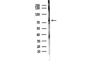 Western blot analysis of lysates from EC304 cells(heat-shock,45 min treatment), using PARN Antibody at 1/1000 dilution.