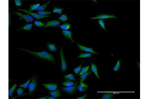 Immunofluorescence of purified MaxPab antibody to INPP5B on HeLa cell. (INPP5B anticorps  (AA 1-748))