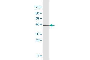 Western Blot detection against Immunogen (40. (Msx2/Hox8 anticorps  (AA 1-133))