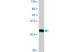 Western Blot detection against Immunogen (37. (PPM1F anticorps  (AA 1-100))
