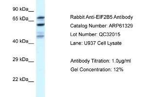 Western Blotting (WB) image for anti-Eukaryotic Translation Initiation Factor 2B, Subunit 5 Epsilon, 82kDa (EIF2B5) (N-Term) antibody (ABIN2788769) (EIF2B5 anticorps  (N-Term))