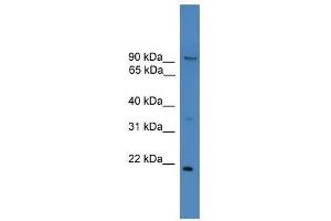 Western Blot showing FOXM1 antibody used at a concentration of 1.