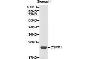 Western Blotting (WB) image for anti-Cysteine and Glycine-Rich Protein 1 (CSRP1) antibody (ABIN1872045) (CSRP1 anticorps)