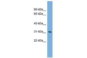 PPM1M antibody used at 1 ug/ml to detect target protein. (PPM1M anticorps  (Middle Region))