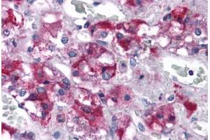 Human Adrenal: Formalin-Fixed, Paraffin-Embedded (FFPE) (RIMS2 anticorps  (C-Term))