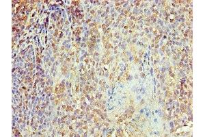 Immunohistochemistry of paraffin-embedded human tonsil tissue using ABIN7156126 at dilution of 1:100