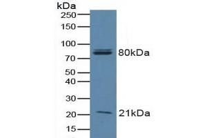 Detection of BAD in Human A549 Cells using Polyclonal Antibody to Bcl2 Associated Death Promoter (BAD) (BAD anticorps  (AA 1-168))