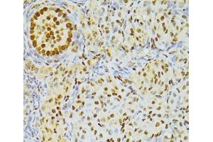 Immunohistochemistry of paraffin-embedded Rat ovary using ALYREF Polyclonal Antibody at dilution of 1:100 (40x lens). (THO Complex 4 anticorps)