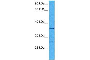 Host:  Mouse  Target Name:  HIF1AN  Sample Tissue:  Mouse Brain  Antibody Dilution:  1ug/ml (HIF1AN anticorps  (Middle Region))
