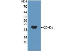 Detection of Recombinant bACE2, Human using Polyclonal Antibody to Beta Secretase 2 (BACE2) (BACE2 anticorps  (AA 230-396))