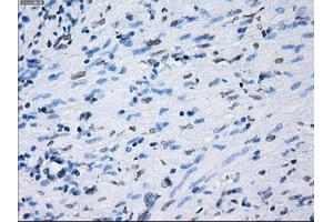 Immunohistochemical staining of paraffin-embedded Ovary tissue using anti-PSMA7mouse monoclonal antibody. (PSMA7 anticorps)