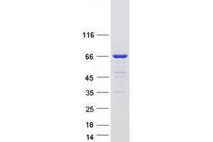 Validation with Western Blot