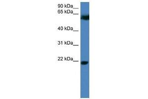 Western Blot showing FBXO32 antibody used at a concentration of 1-2 ug/ml to detect its target protein. (FBXO32 anticorps  (N-Term))