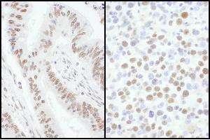 Immunohistochemistry (IHC) image for anti-Splicing Factor, Arginine/Serine Rich 7 (SFRS7) (AA 75-125) antibody (ABIN7453546)