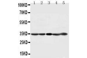 Anti-CDK1 antibody, Western blotting Lane 1: HELA Cell Lysate Lane 2: 293T Cell Lysate Lane 3: A431 Cell Lysate Lane 4: CEM Cell Lysate Lane 5: JURKAT Cell Lysate (CDK1 anticorps  (C-Term))