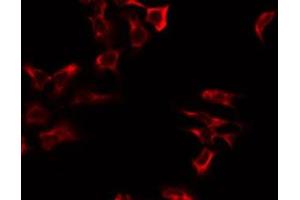 ABIN6275104 staining LOVO by IF/ICC. (GFM2 anticorps  (Internal Region))