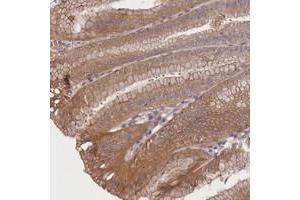 Immunohistochemical staining of human stomach with TMEM39A polyclonal antibody  shows moderate cytoplasmic positivity in glandular cells at 1:10-1:20 dilution. (TMEM39A anticorps)