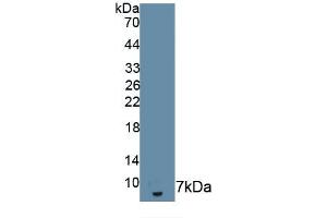 Detection of Recombinant IL18R1, Human using Monoclonal Antibody to Interleukin 18 Receptor 1 (IL18R1) (IL18R1 anticorps  (AA 375-428))