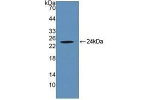 Detection of Recombinant CRYaB, Human using Polyclonal Antibody to Crystallin Alpha B (CRYaB) (CRYAB anticorps  (AA 1-175))