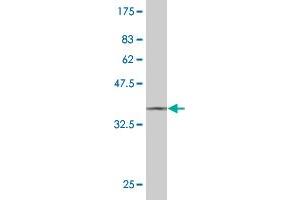 Western Blot detection against Immunogen (37. (STYK1 anticorps  (AA 50-159))
