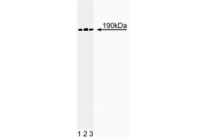 Western blot analysis of p190-B on a A431 cell lysate (Human epithelial carcinoma, ATCC CRL-1555). (ARHGAP5 anticorps  (AA 1102-1214))